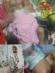 Berulang Kali Masuk RS, Asha Balita Pengidap Penyakit Penyumbatan Empedu Asal Kerinci Butuh Uluran Tangan