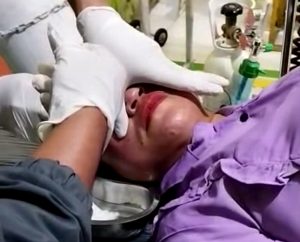 IRT di Kerinci Disiram Air Keras Oleh OTK